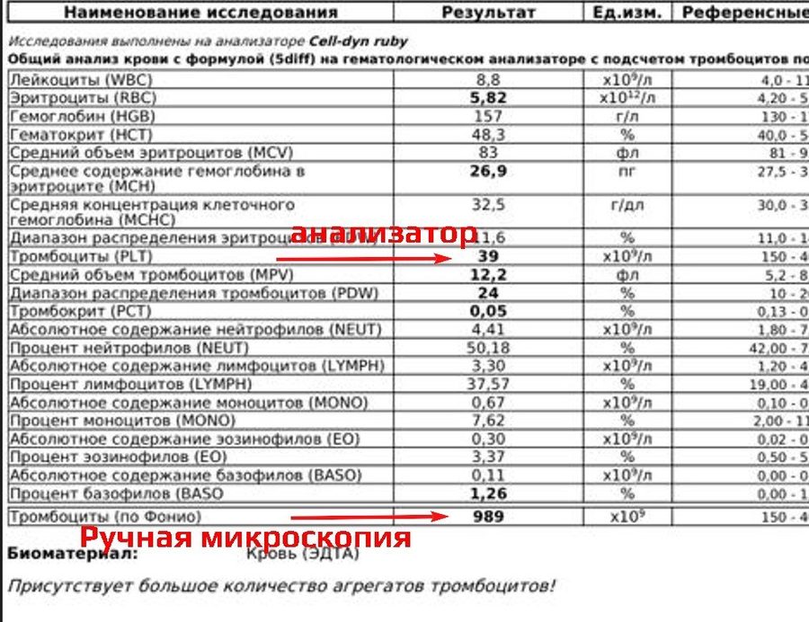 Подсчет тромбоцитов при ЭДТА-зависимой псевдотромбоцитопении