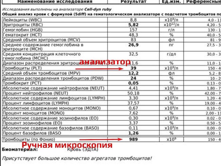 Complete blood count form with platelet discrepancy between analyzer and Fonio method