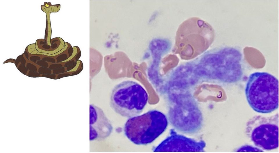 Smear: elongated proplatelet of unusual convoluted shape