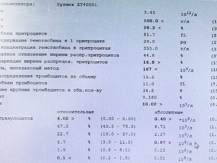 Распечатка анализатора Sysmex XT4000i: гемоглобин 100 г/л, тромбоциты 167×10⁹/л