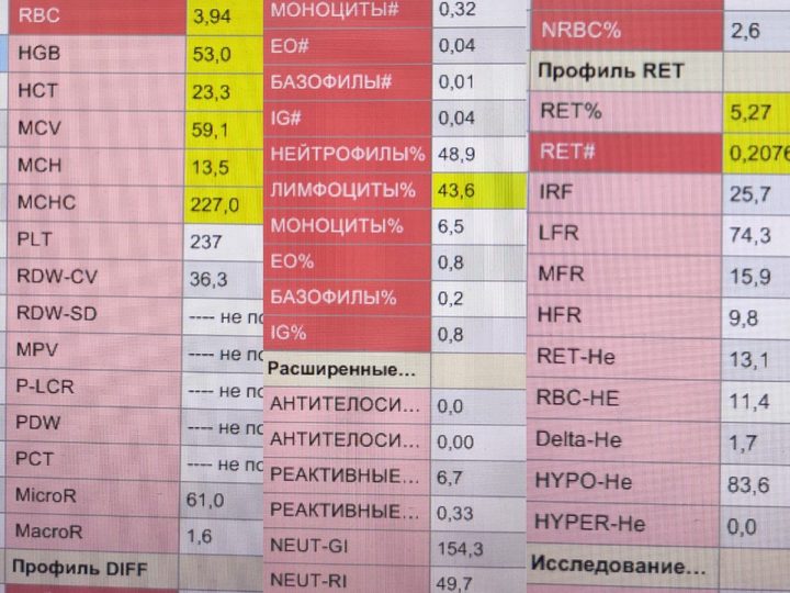 Распечатка анализатора: выраженная гипохромия, MCV 59,1 фл, HGB 53 г/л, RDW 36,3%