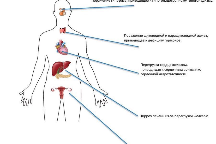 Диагноз — талассемия. Как подготовиться к беременности?