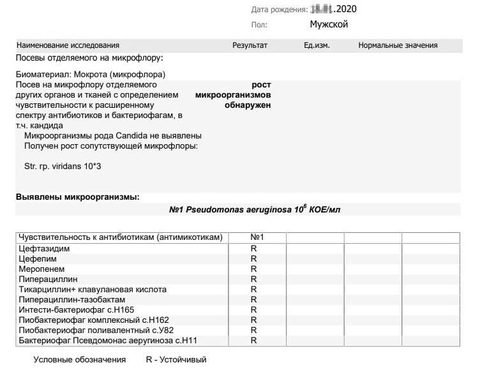 Поза «треноги», характерная при воспалении надгортанника