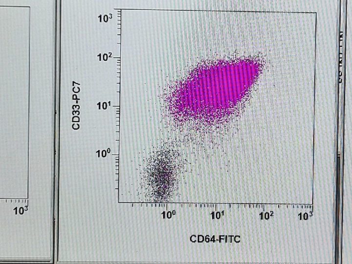 Проточная цитометрия: подтверждение моноцитарного ряда по маркерам CD33, CD64, CD36