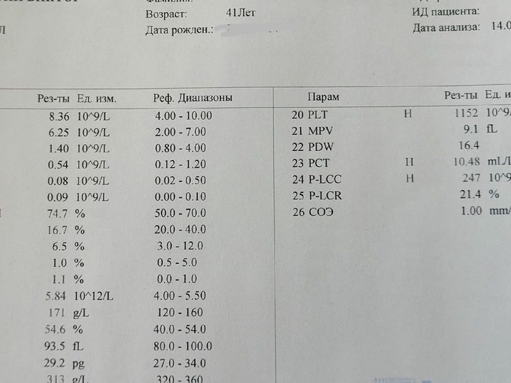 Распечатка анализатора: уровень тромбоцитов составляет 1152×10⁹/л