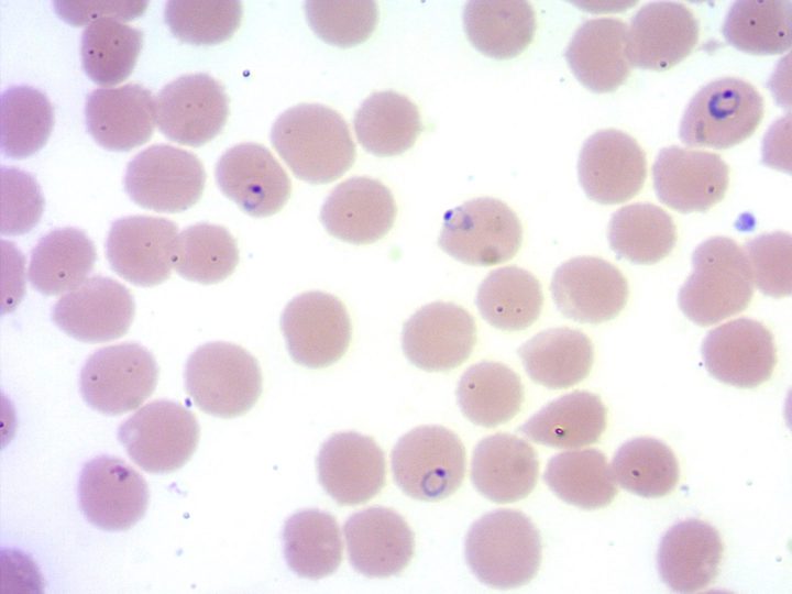 Blood smear: malaria plasmodium rings, including appliqué forms