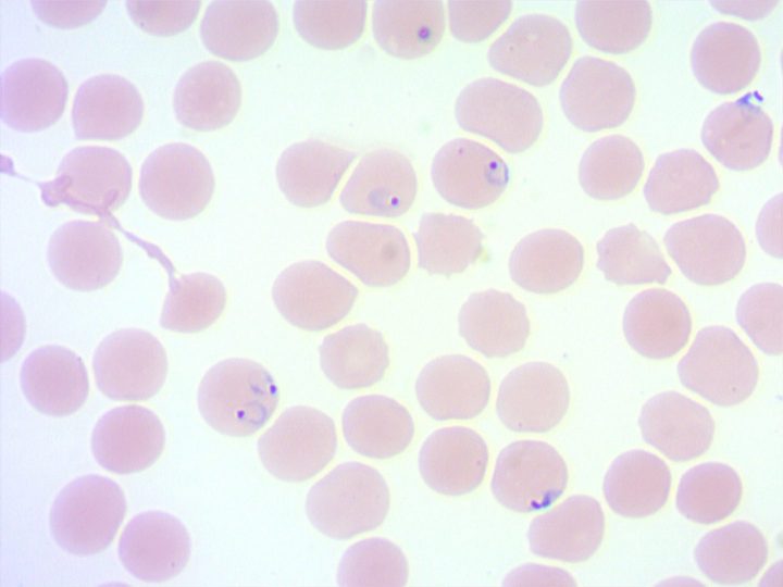 Blood smear: small rings of Plasmodium falciparum at the trophozoite stage