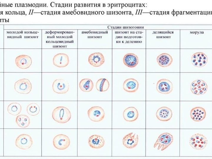 Схема стадий эритроцитарной шизогонии и гаметогенеза малярийных плазмодиев