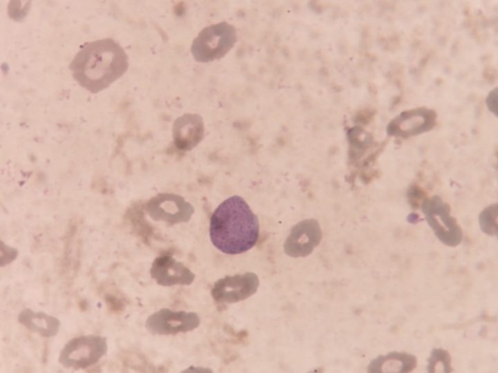 Blood smear: erythrocyte with basophilic stippling in the center of the field