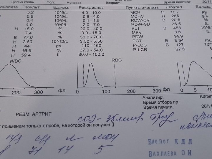 Распечатка анализатора: HGB 44 г/л, MCV 59,4 фл, гипохромия и тромбоцитоз