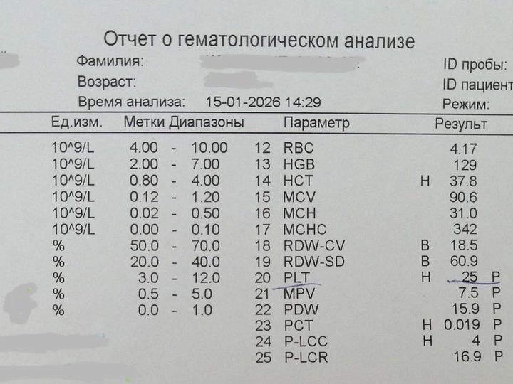 Распечатка анализатора: лейкоцитоз WBC 60,37×10⁹/л и тромбоцитопения PLT 25