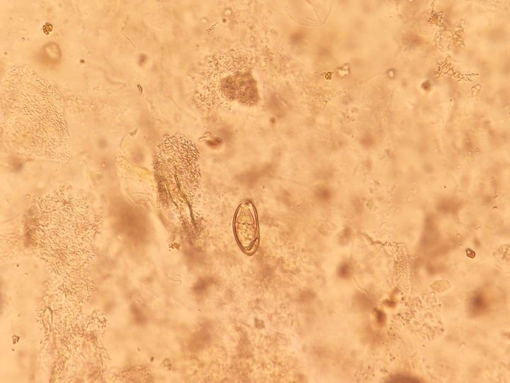 Opisthorchis egg in bile, ×40
