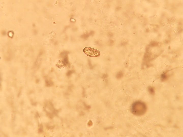 Characteristic oval Opisthorchis egg in a bile sample