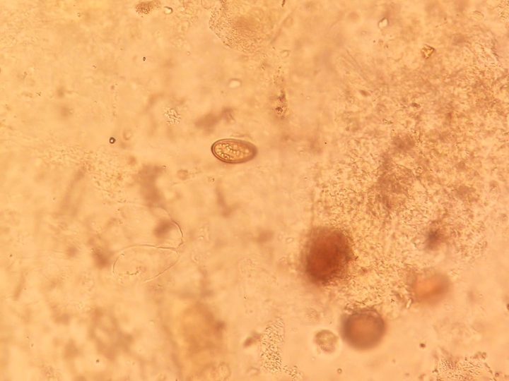 Single Opisthorchis egg in bile under the microscope
