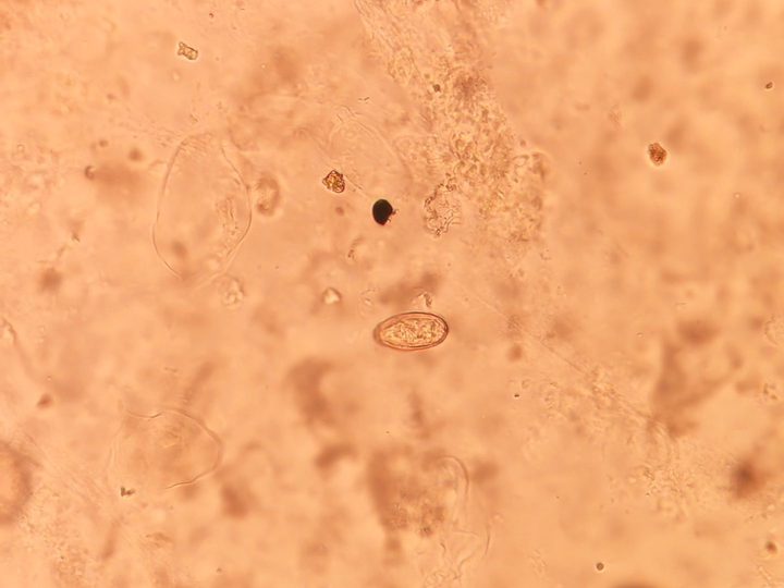 Opisthorchis egg in bile — overview of the field