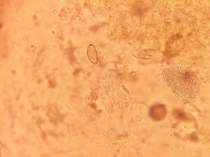 Opisthorchis egg next to debris in bile